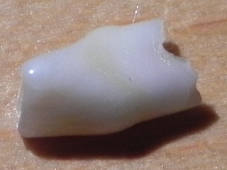 The tooth, image 1