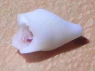 The tooth, image 2