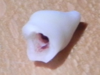 The tooth, image 3