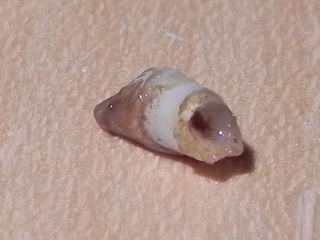 The tooth, image 4