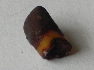The tooth, image 6